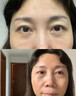 焦博士日本咖啡因眼霜去眼袋消除重度眼袋专用女男士淡化细纹提拉紧致 实拍图