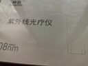 邦臣（BANGCHEN）308白癜风治疗仪光疗仪医院紫外线灯同款银屑病白斑窄谱nbuvb激光 【强度20/面积3 】标准款UV308A1 实拍图