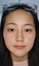 岩井昃弘去痣点痣膏药水专用脸部不留疤祛斑点斑儿童成年人疣祛黑痣去肉粒 一盒装【无痛无痕100%去除】 美容院同款神器官正品方修复液 晒单实拍图