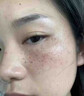 IOEO5%氨甲环酸精华液传明酸湿敷液黄褐斑医美术后外用美容院湿敷面膜 【周期装】1%3%5% 实拍图