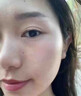 IOEO5%氨甲环酸精华液传明酸湿敷液黄褐斑医美术后外用美容院湿敷面膜 【周期装】1%3%5% 实拍图