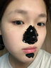 宝姿莱细净导出精华液黑头导出液清洁黑头男女士美容院护肤品软化溶解水 黑头导出液 实拍图