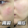 ORGINESE补水喷雾玻尿酸小分子保湿喷雾爽肤水湿敷水护肤化妆提亮男女礼物 实拍图