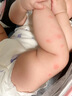 纽医生蚊虫叮咬止痒消肿婴幼儿童宝宝医用凝胶非紫草膏成人防护消包舒缓 实拍图