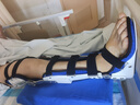 怡辉（YIHUI）膝关节固定支具医用支架可调节下肢外固定支具术后固定护具右脚 实拍图