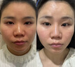 OHBT黄芪面膜10片抗皱紧致抗衰老补水熬夜焕白淡斑女男士金榜第1名 实拍图