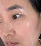 医用冷敷贴面膜型械字号透明质酸钠修复贴敷料医美术后消炎去红美白补水晒后修复收缩毛孔祛痘控油淡化痘印 实拍图