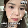 秀瑟祛皱抗皱精华液淡化细纹去皱纹鱼尾纹祛法令纹眼纹4D生物酶注氧液 1瓶装【日常维稳】 实拍图