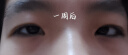 儒意（RUYI）咖啡因眼霜50g 淡化细纹提拉紧致眼周祛除熬夜黑眼圈眼袋抗皱衰老 实拍图