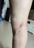 共勉然共勉山美共勉官网旗舰正品青筋凸起静A脉曲张蚯蚓腿下肢酸胀 4盒（买3盒送1） 晒单实拍图