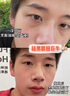 焦博士日本眼霜去眼袋消除重度眼袋专用黑眼圈重度去除女男士中老年神器 实拍图