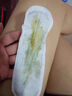 雪莲贴私密处护垫去异味止痒抑菌杀菌妇科医用护理中药纯棉卫生巾 三盒超值装（18片） 153mm 18片 实拍图