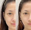 雅萌（YAMAN）达人专属ACE六代双蛋白美容仪 家用面部大排灯 嫩肤提拉紧致【生日礼物送礼送人】 实拍图