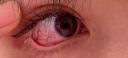 久卜制药叶黄素滴眼液缓解疲劳眼干眼涩视力模糊发痒红血丝消炎止痒3盒 实拍图