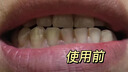 BEAI美白洗牙粉珍珠洁牙粉去异味口臭去黄去牙渍去烟渍结石 50g 实拍图