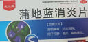 龙仕康 蒲地蓝消炎片非口服液54片 感冒药扁桃体咽嗓子疼治喉咙痛的药喉咙发炎消炎药浦地黄消炎片蒲地兰 实拍图