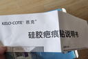 芭克kelocote美国疤巴克辅助祛疤贴治疗疤痕硅胶疤痕贴5x7.5cm标准款 实拍图