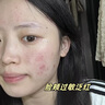 透真玫瑰大粉水补水保湿敷爽肤水舒缓泛红护肤控油抗皱紧致纯露干敏皮 实拍图