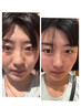 OHBT白松露面部精华油45g以油养肤脸部护肤油去黄抗皱淡纹抗衰精华液 实拍图