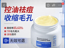 OHBT水杨酸祛痘清洁泥膜150g 面膜控油去黑头清洁收缩毛孔去粉刺闭口 实拍图