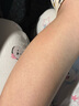 示博士鸡皮肤疙瘩搭毛囊角化症专用的药去角质大腿手臂去除神器特傚膏用 一套【喷剂+乳膏】轻度鸡皮 搭身体乳去鸡皮毛囊角质疙瘩品用 实拍图
