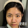 润凰美白祛痘淡斑毛孔收缩精华液抗皱紧致精华抗衰老紧致烟酰胺女男士 1瓶 【挑战3天白嫩肌】 实拍图