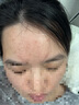 谷雨白千控油护肤套装（水+乳+祛痘凝胶）补水保湿修护淡痘印护肤品 实拍图