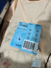 999旭发二硫化硒洗剂2.5%150g*3盒毛囊炎洗发水头屑去屑止痒控油脱发头皮脂溢性皮炎花斑癣汗斑 实拍图