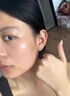 OURHEAL美国医用毛孔收缩精华液毛孔粗大修复细致去黑头粉刺闭口女男士 实拍图