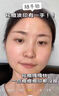 Newliann医用黑面膜械字号祛痘祛痘印术后消炎修复医美美白补水修护男士女 实拍图