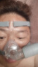 麦德哈特德国品牌呼吸机打呼噜双水平全自动止鼾器无创家用睡眠呼吸暂停 【升级双水平中重度止鼾】医用25压力呼吸机25B 实拍图