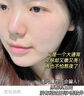 韩方五谷377美白补水保湿水乳液2件套装爽肤水祛斑霜护肤化妆品 实拍图