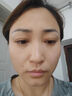 ORGINESE377美白祛斑面霜提亮去黄祛黄褐斑雀斑保湿滋润补水淡斑男女士 实拍图