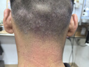 上海硫磺皂后背除螨皂抑菌控油爽肤洗脸香皂沐浴洗澡洗头发肥皂 85克*5（拍3件送皂盒） 硫磺香皂 实拍图