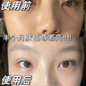 韩方五谷377美白祛斑精华爽肤水乳去黄提亮补水保湿男女士护肤化妆品套装 实拍图