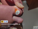 DR.SCT鸡眼贴鸡眼膏去除祛根去肉刺刺猴无痛脱落鸡眼连根拔跖疣专用非药 实拍图