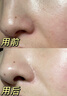 OHBT紫苏果酸清洁泥膜150g面膜深层清洁去黑头收缩毛孔祛痘金榜第1名 实拍图