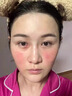 医用冷敷贴面膜械字号医美术后消炎美白补水晒后修复收缩毛孔祛痘淡化痘印生长因子重组三型人源胶原蛋白敷料 实拍图