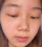 ORGINESE玻色因眼霜淡化细纹提拉紧致搭黑眼圈重度去除眼袋咖啡因30-40-50 实拍图