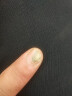 Dr.JYS脚医生甲卫士4ml灰指甲专用护理盒抑菌液灰甲净药监备案 实拍图