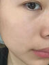 医用精华液械字号收缩毛孔粗大修复细致去黑头粉刺闭口男士女士祛痘印黑色素沉淀控油淡化痘印痘坑透明质酸钠 实拍图