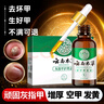 纯春堂云南本草灰指甲专用特殊效中草药抑菌液增厚发黄中空灰甲净护理盒 实拍图