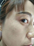 肤研老年斑专用膏药一夜消去斑去黑色素霜去除男士祛斑点斑专用的药水 特效1盒【日本进口】医用正品 医用正品祛斑霜美白淡化黄褐雀斑 实拍图