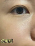 焦博士日本眼霜去眼袋消除重度眼袋专用黑眼圈重度去除女男士中老年神器 实拍图