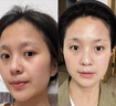 OHBT377氨基酸洗面奶300g美白淡斑提亮肤色男女士祛痘黑头粉刺洁面乳 实拍图