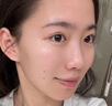Newliann医用黑面膜械字号祛痘祛痘印术后消炎修复医美美白补水修护男士女 实拍图
