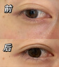 ORGINESE眼部脂肪粒眼霜油脂粒淡化细纹提拉紧致眼周黑眼圈抗皱紧致熬夜女 实拍图