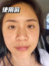 Newliann医用重组胶原蛋白修复敷料乳液人表皮生长因子凝胶皮肤屏障面霜 实拍图