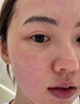 Newliann医用重组胶原蛋白修复敷料乳液人表皮生长因子凝胶皮肤屏障面霜 实拍图