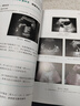 影像读片从入门到精通系列--超声读片指南（第三版） 实拍图
